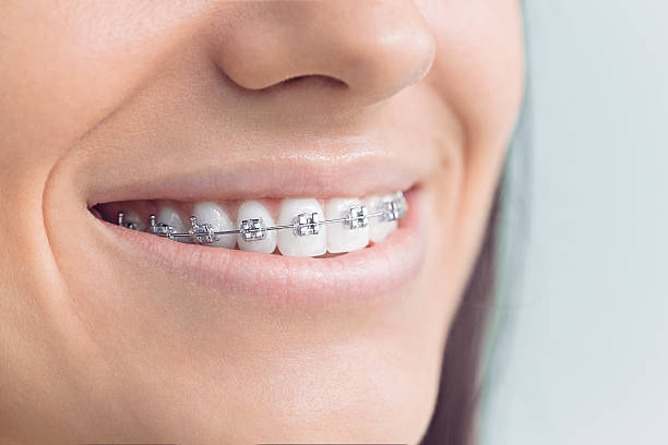 Why Choose Us for Your Dental Needs in Bull Run, VA
